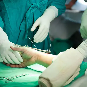Hair Transplant