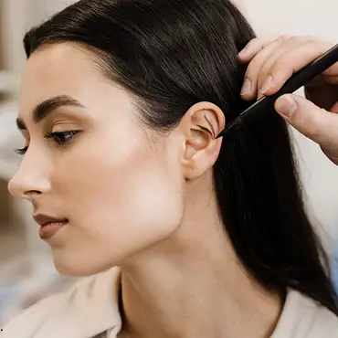 Hair Transplant